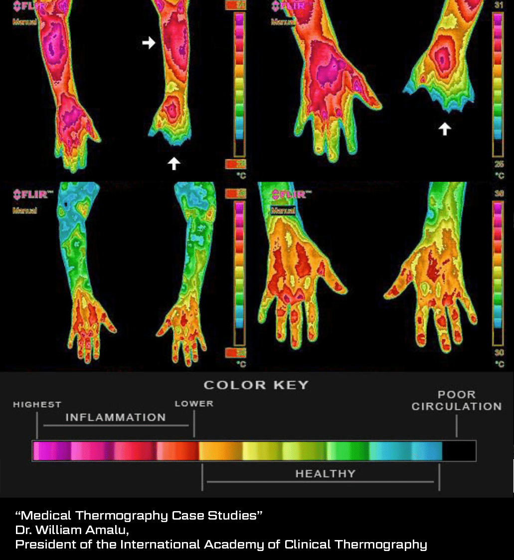 FLIR2