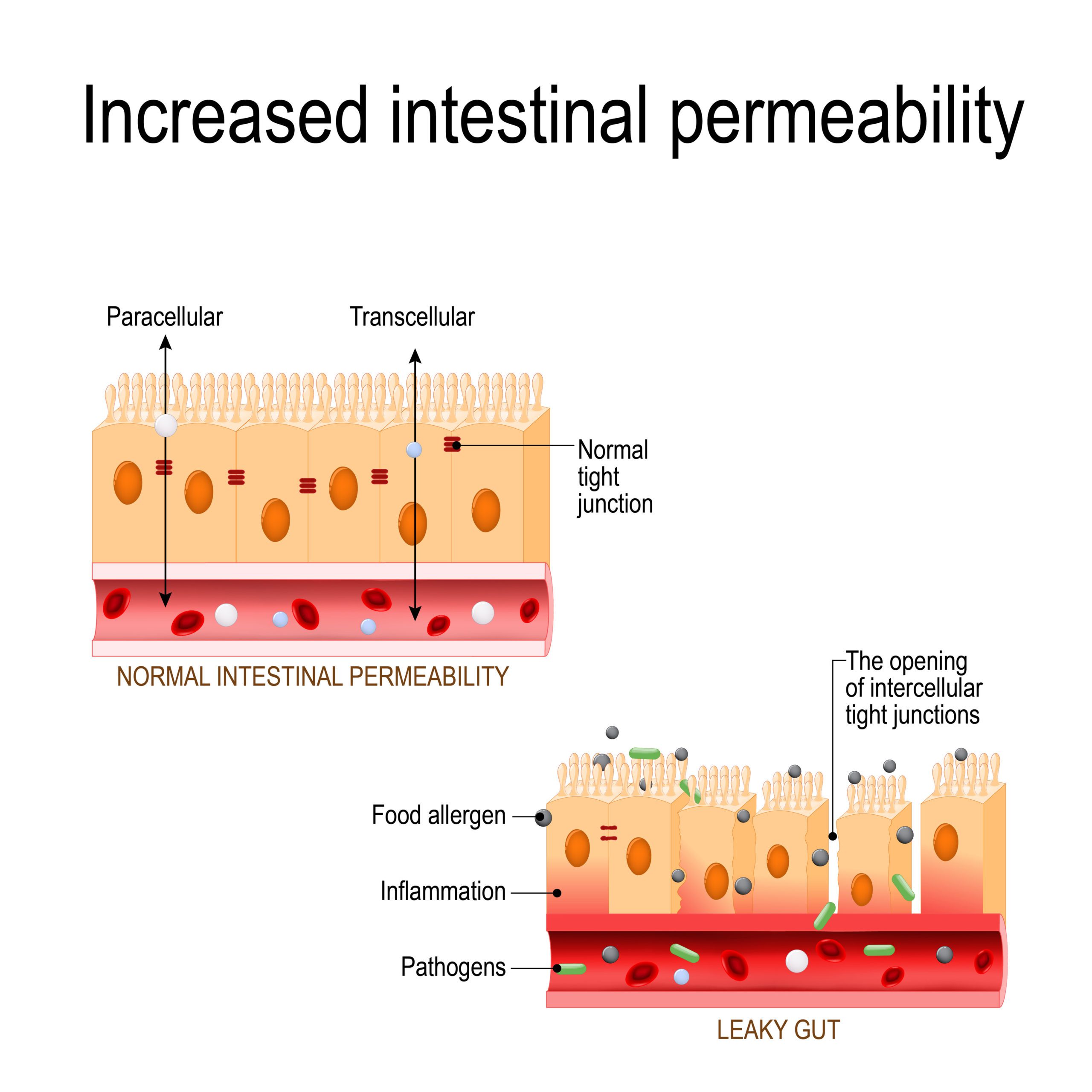 tight junction compromised in leaky gut